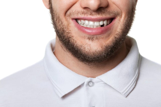 Falta de dientes - Clínicas dentales en Teià